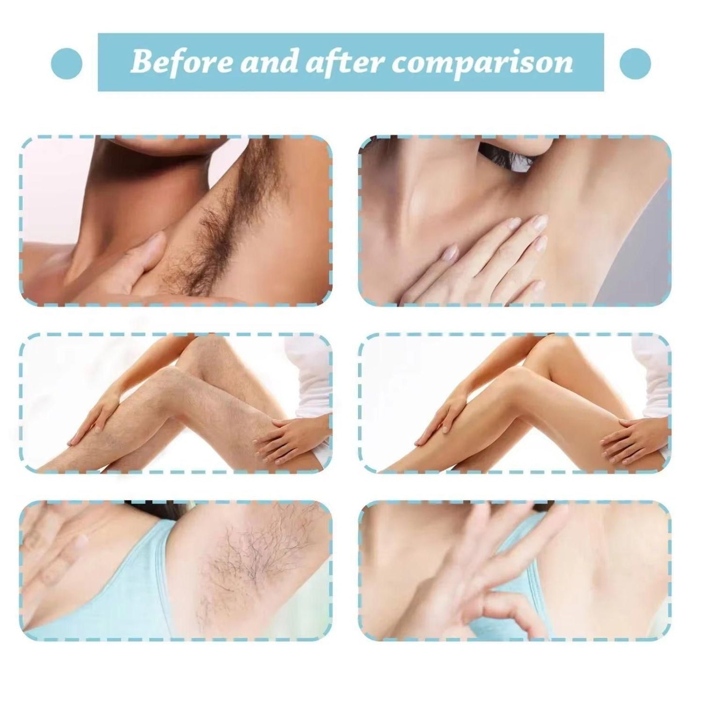 Hair Removal Spray 100 ml Spray. Wipe. Done! Effortless Hair Removal for Men & Women