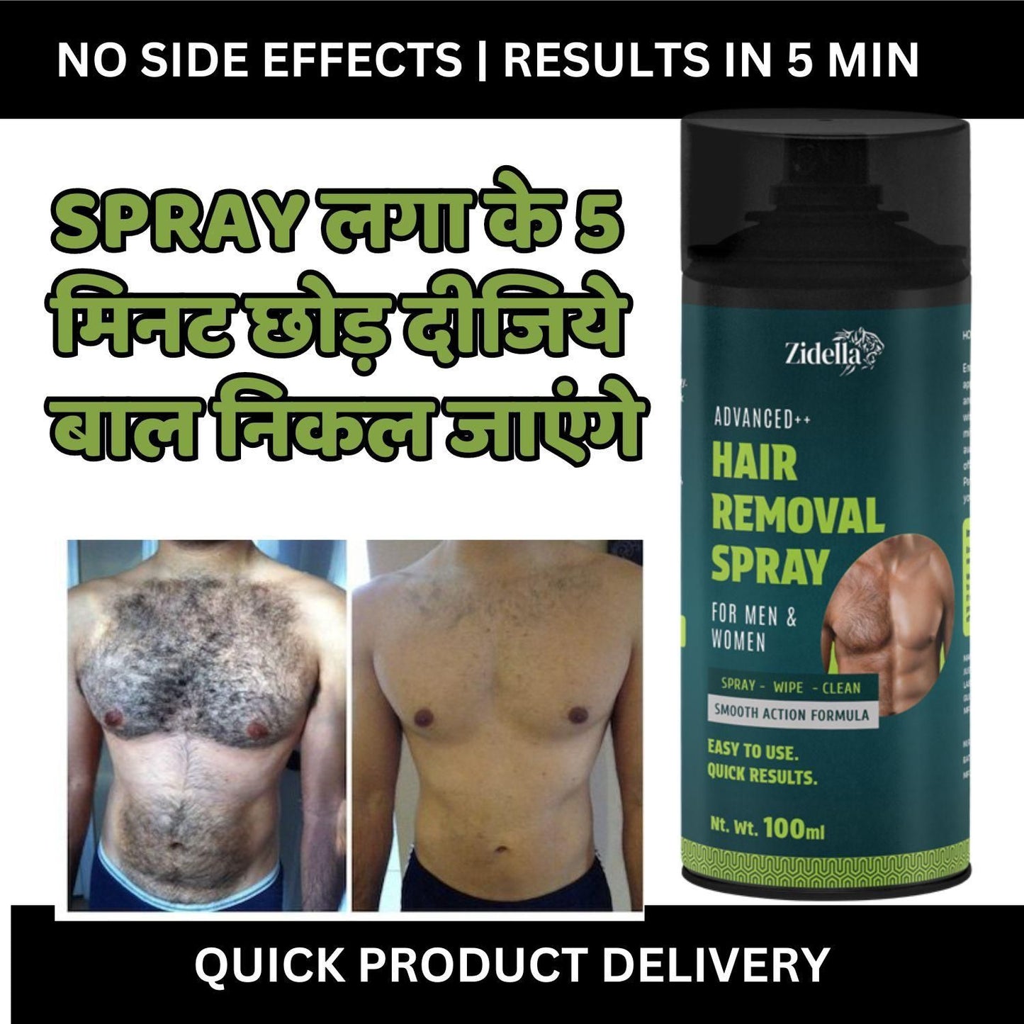 Hair Removal Spray 100 ml Spray. Wipe. Done! Effortless Hair Removal for Men & Women